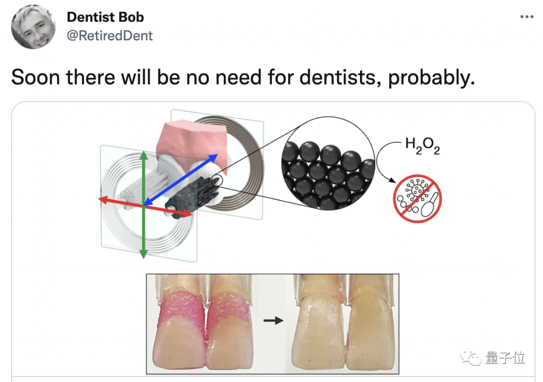 懒得刷牙？微型机器人自动帮你搞定，还能牙刷牙线随时变换