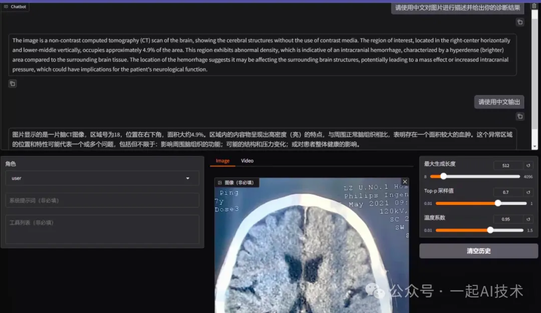 我训练了一个医疗多模态大模型帮家里老人看病-AI.x社区