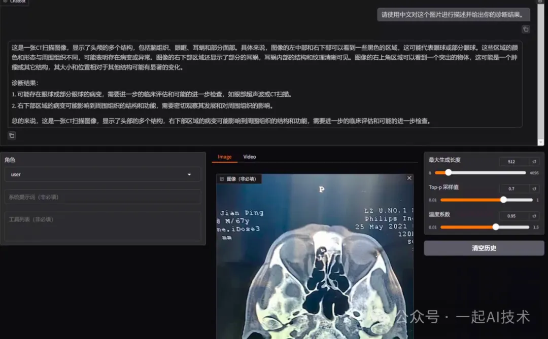 我训练了一个医疗多模态大模型帮家里老人看病-AI.x社区